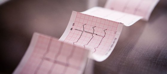 Blutdruck Ein Ergebnisblatt vom EKG.