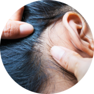 Kopfläuse am Haar Zwei Hände suchen einen Kopf nach Kopfläusen ab